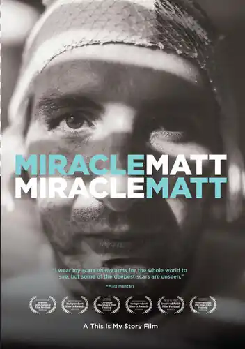 Hot Deal Miracle Matt / (Mod)