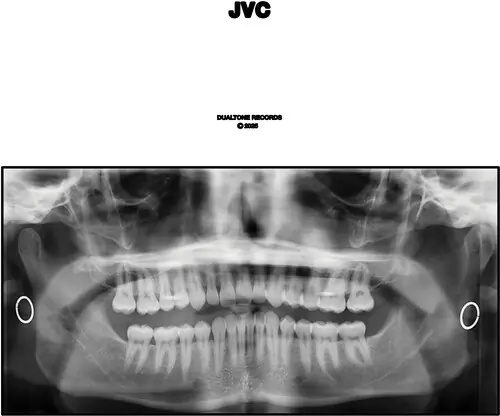Jvc Latest